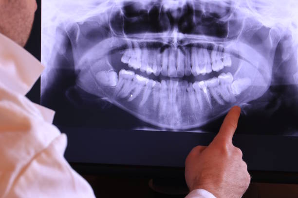 Best Emergency Treatment for Toothache in East Camden, AR