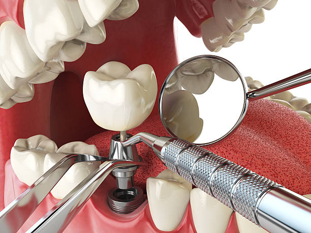 Best Same-Day Emergency Dentist in East Camden, AR